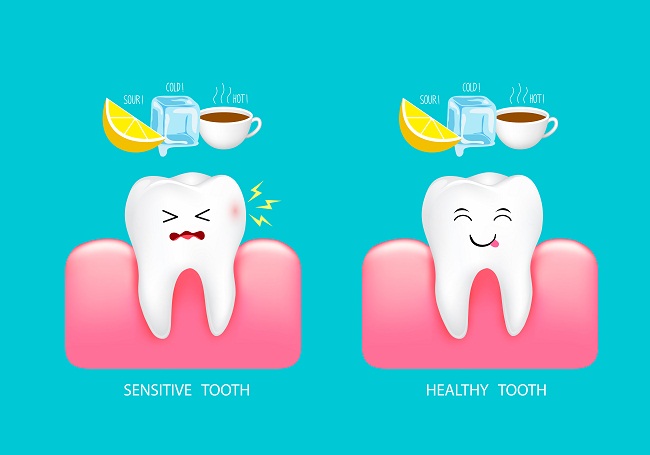 Overcoming Tooth Sensitivity